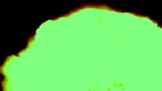 my therapy session in wrestling feels so good... wait, i mean relaxing